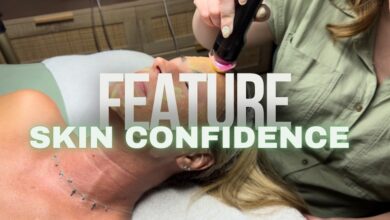 Skin Confidence